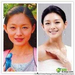 明星网红胸部整形,明星网红的美丽蜕变之路