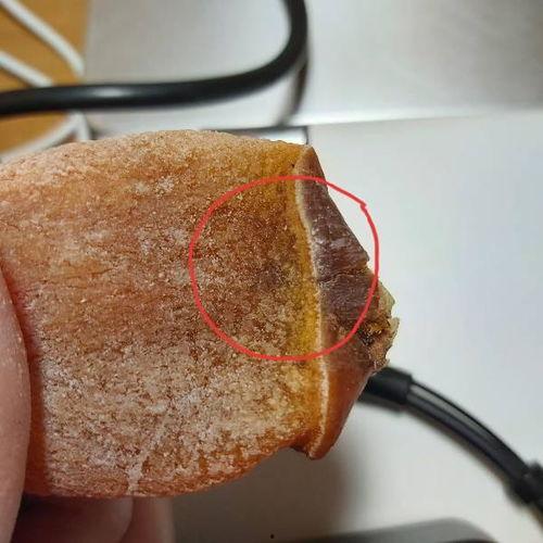 吃酥瓜大便有点黑正常吗,正常现象解析