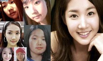 明星网红整容对比,容貌变迁背后的真相揭秘